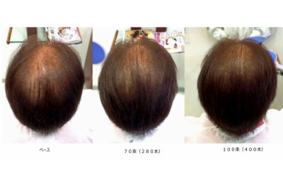 フェルモ：増毛３ステップ：260束ステップ１