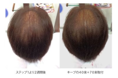 フェルモ：増毛３ステップ：260束ステップ２