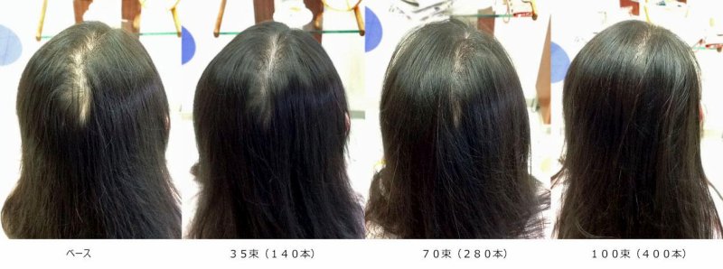 フェルモつむじ割れ：100束（400本）