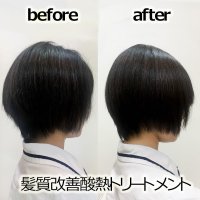 酸熱トリートメント（ショート）